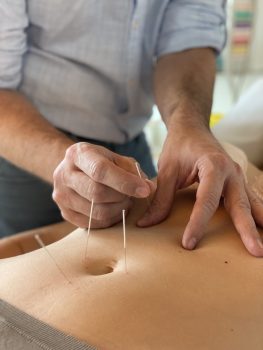 Ganzheitliche Medizin Akupunktur Bauch
